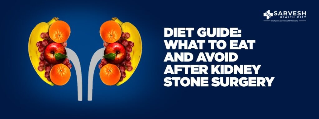 Diet Guide: What to Eat (and Avoid) After Kidney Stone Surgery