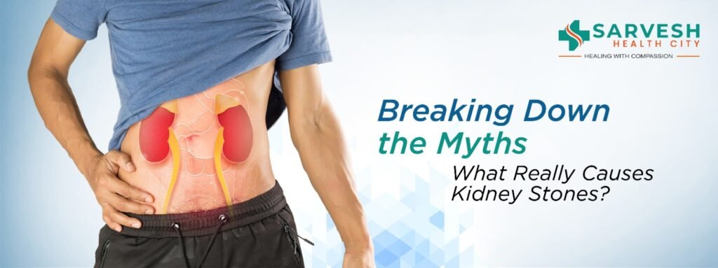Breaking Down the Myths: What Really Causes Kidney Stones?