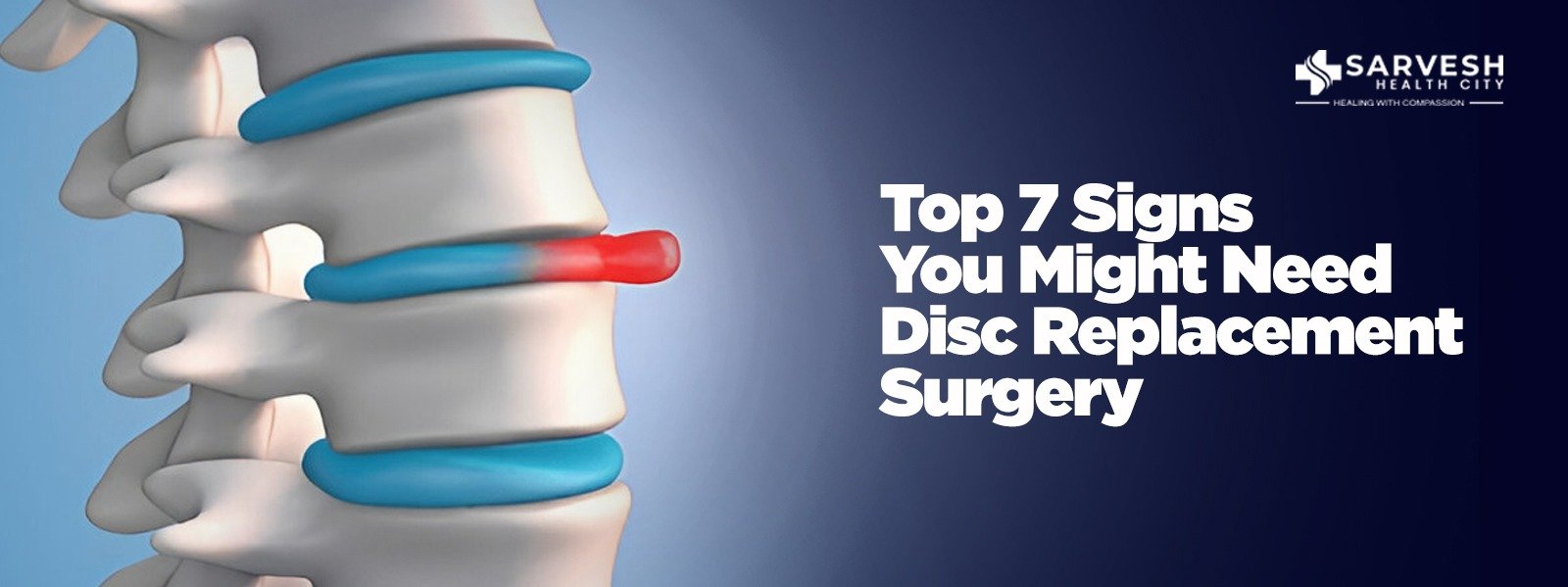 Top 7 Signs You Might Need Disc Replacement Surgery