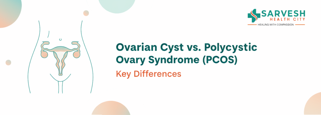 ovarian-cyst-vs-polycystic-ovary-syndrome-pcos-key-differences