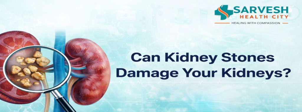 can-kidney-stones-damage-your-kidneys