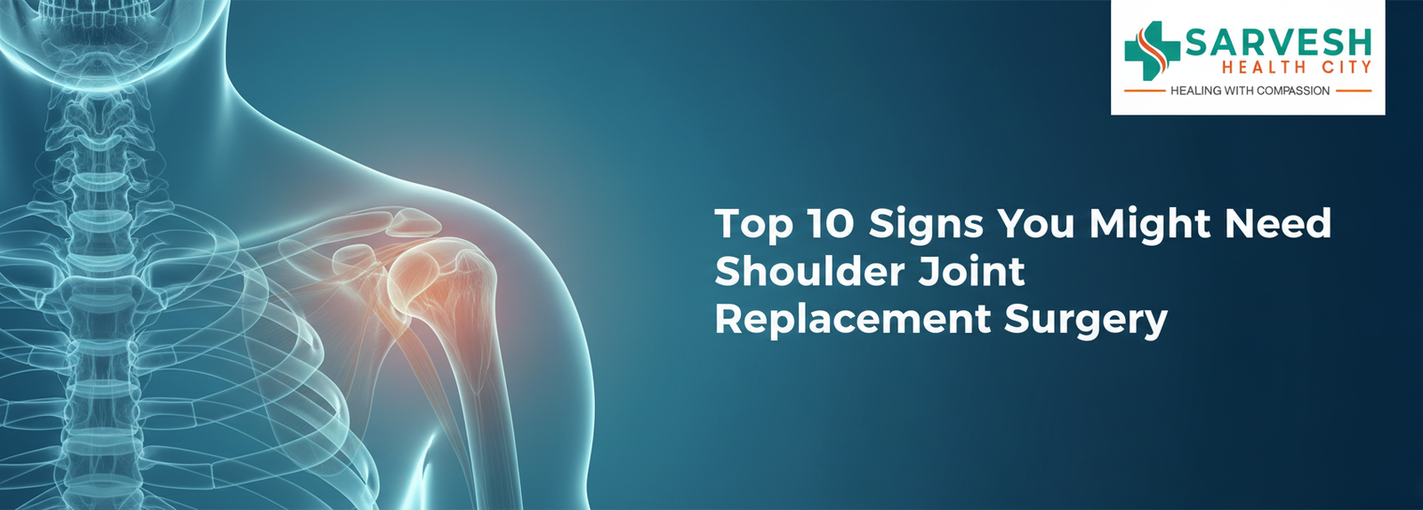 top-10-signs-you-might-need-shoulder-joint-replacement-surgery